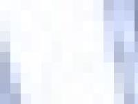 Acabar con Alopecia y Calvicie