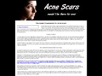 acne-scar-treatment.co.uk 1 day car insurance, banned drivers insurance, employers liability insurance acne-scar-treatment.co.uk 1 day car insurance, banned drivers insurance, employers liability insurance