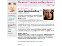 Cure Your Acne Naturally – For Life! Cure Your Acne Naturally – For Life!