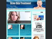 Acne Treatment and Skin Care Acne Treatment and Skin Care