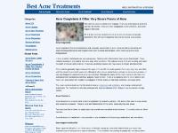 acnetreatments-help.com Best Acne Treatments, Acne 101, Acne Causes acnetreatments-help.com Best Acne Treatments, Acne 101, Acne Causes