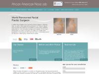 africanamericannosejob.com Ethnic Rhinoplasty, Non-surgical Rhinoplasty, Lifting for a drooping nose