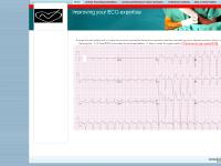 ECG in Heart Failure ECG in Heart Failure