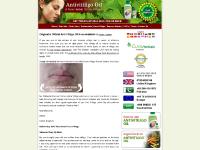 Vitiligo, Vitiligo Treatment, Vitiligo Cure, Skin Disorder, Herbal Treatment in USA Vitiligo, Vitiligo Treatment, Vitiligo Cure, Skin Disorder, Herbal Treatment in USA