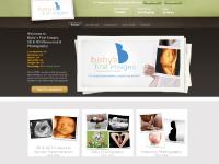 3D Ultrasound and 4D ultrasound - Atlanta, Georgia $39 and up and Newborn Photography, Maternity Photography and Baby Photography.