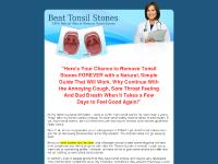 How To Remove Tonsil Stones - 100% Natural Way to cure tonsil stones How To Remove Tonsil Stones - 100% Natural Way to cure tonsil stones