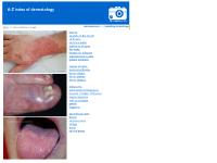 Dermapics.com: pictures and clinical information on skin disease. Dermapics.com: pictures and clinical information on skin disease.