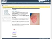Eczema Forum | Eczema Symptoms and Dermatitus Treatment Forums - Welcome Eczema Forum | Eczema Symptoms and Dermatitus Treatment Forums - Welcome