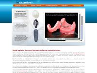 inclusivedental.com Inclusive Dental Implants Prosthetic Options Inclusive Resources Implant Abutments Treatment Planning Implant Dentures Titanium Implants Dental Implants Lab treatment planning