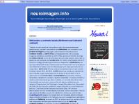 archivo neuroimagen, artículos, cabeza/cuello, columna archivo neuroimagen, artículos, cabeza/cuello, columna