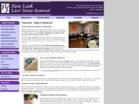 Houston Tattoo Removal | Laser Tattoo Removal Houston | New Look Houston Tattoo Removal | Laser Tattoo Removal Houston | New Look