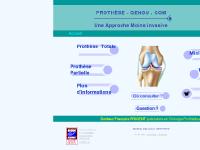 prothese-genou.com prothese du genou, prothese de genou, prothese totale genou