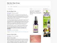 Hives Symptoms, Allergy Hives, rash, Son Has Allergy Hives Hives Symptoms, Allergy Hives, rash, Son Has Allergy Hives