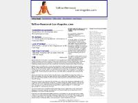 tattoo-removal-los-angeles.com angeles los removal tattoo, jersey new removal tattoo, nyc removal tattoo