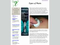 Types of Warts - what are warts and how do we get rid of warts Types of Warts - what are warts and how do we get rid of warts