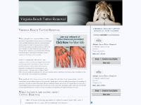 virginiabeachtattooremoval.com tattoo removal, cost, before and after virginiabeachtattooremoval.com tattoo removal, cost, before and after